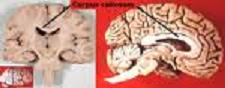 Get more information -how the brain works corpus calossum